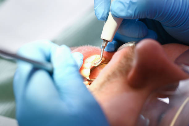 Best Pediatric Emergency Dentist in Crestwood, IL